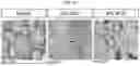 Fig. 22 - IMAGING-ENABLED BIOREACTOR FOR IN VITRO CULTIVATION AND BIOENGINEERING OF ISOLATED AIRWAY TISSUE