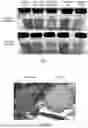 Fig. 02 - Bleaching trichomes to remove proteins
