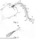 Fig. 02 - Radially compressible and expandable rotor for a fluid pump