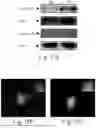 Fig. 19 - FUNCTIONAL POROSOME MANIPULATION