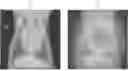 Fig. 01 - SYSTEMS AND METHODS FOR ASSESSING PET RADIOLOGY IMAGES