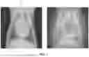 Fig. 02 - SYSTEMS AND METHODS FOR ASSESSING PET RADIOLOGY IMAGES