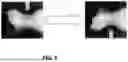 Fig. 07 - SYSTEMS AND METHODS FOR ASSESSING PET RADIOLOGY IMAGES