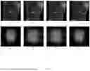 Fig. 02 - PHYSICALLY-PRIMED DEEP-NEURAL-NETWORKS FOR GENERALIZED UNDERSAMPLED MRI RECONSTRUCTION
