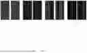 Fig. 04 - PHYSICALLY-PRIMED DEEP-NEURAL-NETWORKS FOR GENERALIZED UNDERSAMPLED MRI RECONSTRUCTION