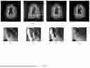 Fig. 06 - PHYSICALLY-PRIMED DEEP-NEURAL-NETWORKS FOR GENERALIZED UNDERSAMPLED MRI RECONSTRUCTION