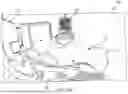 Fig. 08 - SYSTEMS AND METHODS FOR REGISTERING A 3D REPRESENTATION OF A PATIENT WITH A MEDICAL DEVICE FOR PATIENT ALIGNMENT