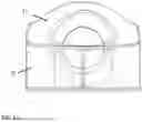 Fig. 22 - TOTAL MESORECTAL EXCISION SURGICAL SIMULATOR