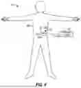 Fig. 03 - FREEFORM TEXT ANALYSIS AND PROCESSING FOR NEUROSTIMULATION DATA