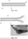 Fig. 10 - CORE-SUBSTRATE, SUBSTRATE AND USE OF SUBSTRATE FOR SEMICONDUCTOR PACKAGING