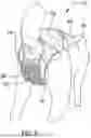 Fig. 06 - Animal birth control device and methods of use