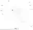 Fig. 05 - Child carrier