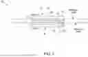 Fig. 02 - DEVICES AND METHODS FOR ASSISTING MAGNETIC COMPRESSION ANASTOMOSIS