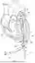 Fig. 10 - MULTI-LUMEN CARDIAC ACCESS