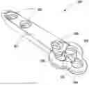 Fig. 01 - Combined Intramedullary - Extramedullary Bone Stabilization and Alignment System