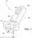 Fig. 03 - Combined Intramedullary - Extramedullary Bone Stabilization and Alignment System