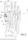 Fig. 07 - Combined Intramedullary - Extramedullary Bone Stabilization and Alignment System