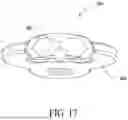 Fig. 16 - Combined Intramedullary - Extramedullary Bone Stabilization and Alignment System