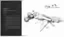 Fig. 30 - Combined Intramedullary - Extramedullary Bone Stabilization and Alignment System