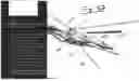 Fig. 49 - Combined Intramedullary - Extramedullary Bone Stabilization and Alignment System