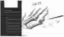 Fig. 53 - Combined Intramedullary - Extramedullary Bone Stabilization and Alignment System