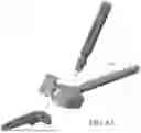 Fig. 59 - Combined Intramedullary - Extramedullary Bone Stabilization and Alignment System