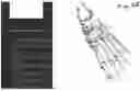 Fig. 63 - Combined Intramedullary - Extramedullary Bone Stabilization and Alignment System