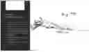 Fig. 67 - Combined Intramedullary - Extramedullary Bone Stabilization and Alignment System