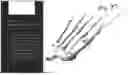 Fig. 84 - Combined Intramedullary - Extramedullary Bone Stabilization and Alignment System