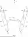 Fig. 02 - SURGICAL OSTEOTOMY FIXATION DEVICES