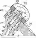 Fig. 01 - SYSTEMS AND METHODS FOR SECURELY ATTACHING AN ANCHOR TO AN IMPLANT BODY