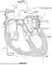 Fig. 40 - MULTI-MODALITY ABLATION CATHETER HAVING A SHAPE MEMORY STYLET