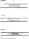 Fig. 07 - MULTI-SOURCE TISSUE ABLATION SYSTEM FOR THE INTERNAL TREATMENT OF PARENCHYMAL ORGANS, HOLLOW ANATOMICAL CONDUITS OR BLOOD VESSELS