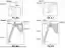 Fig. 41 - MULTI-BONE PREDICTION FOR ORTHOPAEDIC PROCEDURES