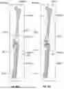 Fig. 43 - MULTI-BONE PREDICTION FOR ORTHOPAEDIC PROCEDURES