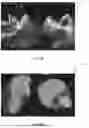 Fig. 04 - LEFT ATRIAL APPENDAGE CLOSURE PRE-PROCEDURE SYSTEM AND METHODS