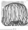 Fig. 10 - LEFT ATRIAL APPENDAGE CLOSURE PRE-PROCEDURE SYSTEM AND METHODS