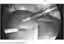 Fig. 01 - METHODS AND SYSTEMS TO AUTOMATE SURGICAL INTERVENTIONS