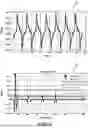 Fig. 07 - FREQUENCY DOMAIN OPPOSED-MODE PHOTOELECTRIC SENSOR