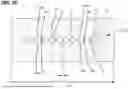 Fig. 15 - PITCH CONVERSION FERRULE BOOT