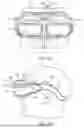 Fig. 04 - Hybrid see through augmented reality systems and methods for low vision users