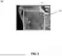Fig. 10 - Dual domain tracking of target structures