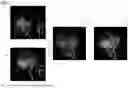 Fig. 02 - Spatiotemporal fusion of time-resolved angiographic data sets