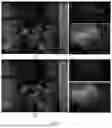 Fig. 09 - Image processing method for performing color migration to correction image according to reference image, and obtaining first scratch image and/or second scratch image so as to obtain scratch repairing image