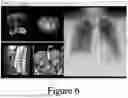 Fig. 08 - Method and system for rule-based anonymized display and data export