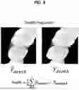 Fig. 07 - METHOD AND SYSTEM FOR AUTOMATING DENTAL CROWN DESIGN BASED ON ARTIFICIAL INTELLIGENCE