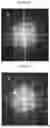 Fig. 06 - POSITIVE ACTIVE MATERIAL FOR RECHARGEABLE LITHIUM BATTERY, METHOD OF PREPARING SAME, AND RECHARGEABLE LITHIUM BATTERY INCLUDING SAME