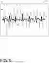 Fig. 06 - PHYSIOLOGICAL PARAMETER RELIABILITY INDICATORS