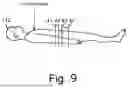 Fig. 10 - DEVICE FOR INFERRING VIRTUAL MONOCHROMATIC X-RAY IMAGE, CT SYSTEM, METHOD OF CREATING TRAINED NEURAL NETWORK, AND STORAGE MEDIUM