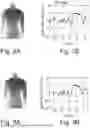 Fig. 03 - CONTACTLESS MEASUREMENT AND VISUALIZATION OF RESPIRATION FOR CHEST RADIOGRAPHY IMAGE EXAMINATIONS